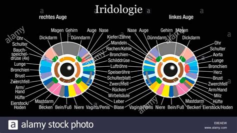 iris nodules differential diagnosis | MAIKONG Iridology Cameras ...