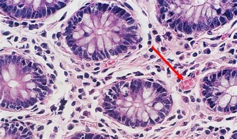 An Intro to H&E Staining: Protocol, Best Practices, Steps & More