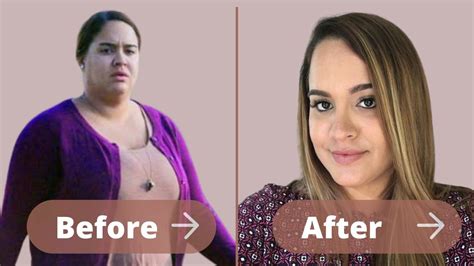 Sydney Simpson Weight Loss: Diet, Workout, Surgery Before & After - Weight Loss