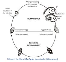 Trichuris trichiura - Wikipedia