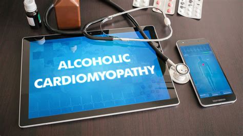 Alcoholic Cardiomyopathy (ACM) | What Is Alcoholic Cardiomyopathy?