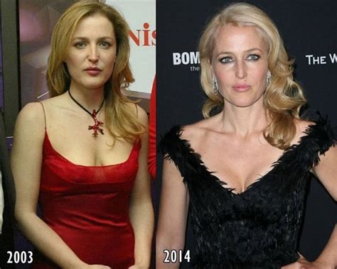 The Right Kind of Changes from Gillian Anderson’s Plastic Surgery | Go Away Paris!