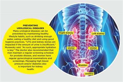 Get to know these common urinary diseases | Sunrise Hospital