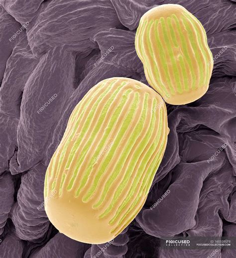 Milkwort pollen grain — biological, microscopical cells - Stock Photo | #160559078