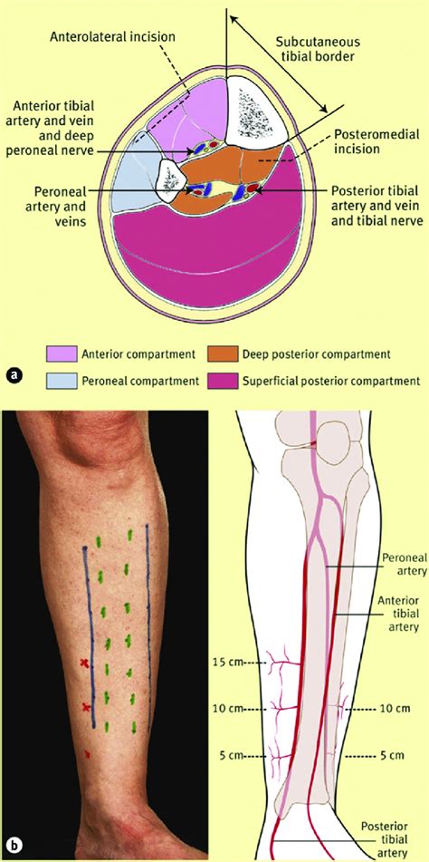 (a) A cross-sectional representation of the leg illustrating all four... | Download Scientific ...