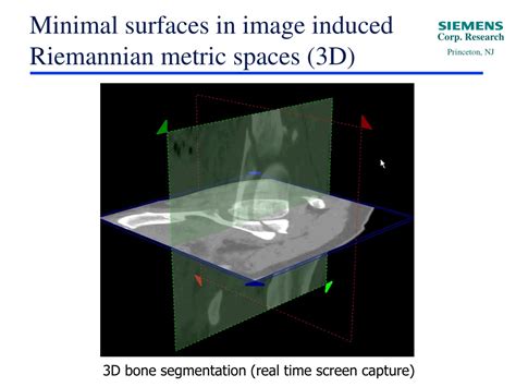 PPT - Computing geodesics and minimal surfaces via graph cuts ...