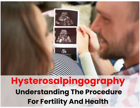 Hysterosalpingography: Understanding The Procedure For Fertility And ...