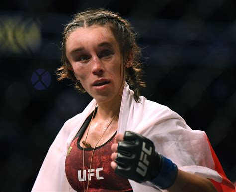 UFC Fighter Joanna Jedrzejczyk's Face Before And After Her Fight Is ...