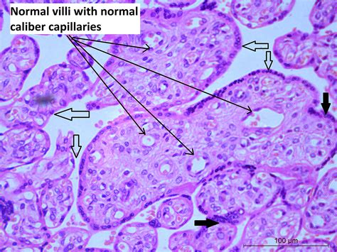 Histology Of Normal Villi In The Late Second Trimeste - vrogue.co