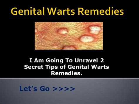 Genital Warts Remedies