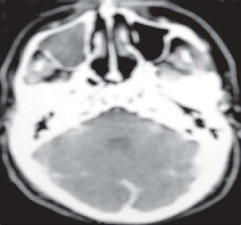 Axial view of CT scan | Download Scientific Diagram