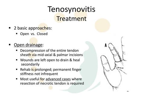 PPT - Hand Infections PowerPoint Presentation - ID:3753697