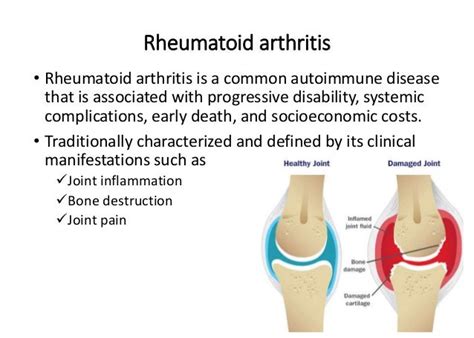 The immunopathogenesis of seropositive rheumatoid arthritis