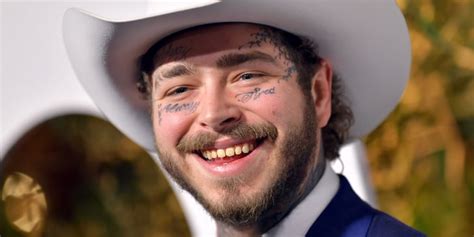 Post Malone's Smile and "Diamond Fangs" Cost $1.6 Million | POPSUGAR ...