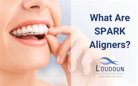 What are SPARK Aligners?