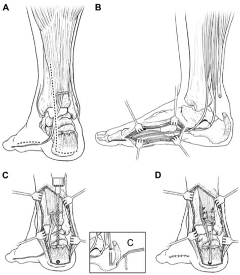 Question 210279 - Qbank - Orthobullets