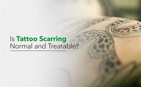 Is Tattoo Scarring Normal and Treatable? - Synergy Wellness