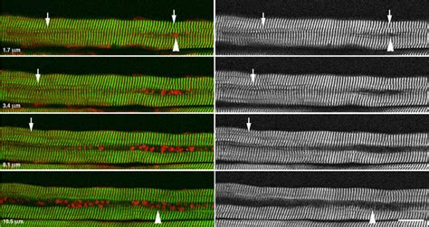 Second Harmonic Generation (SHG) microscopy of a single fiber from an... | Download Scientific ...