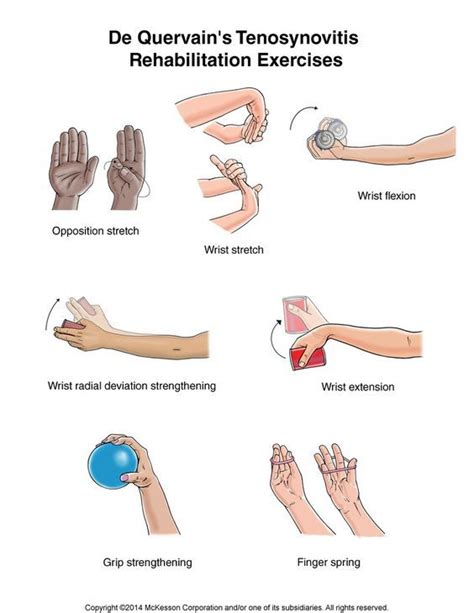 Summit Medical Group - De Quervain's Tenosynovitis Exercises Occupational Therapist, Physical ...