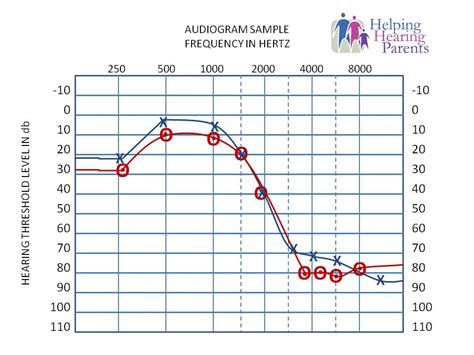 Audiograms: An Explanation on Interpretation | Helping Hearing Parents