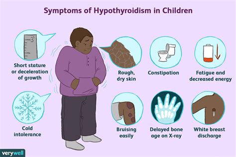 Symptoms of Thyroid Disease in Children