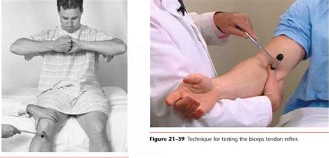 Test the Biceps Tendon Reflex - Physical Diagnosis - Mitch Medical