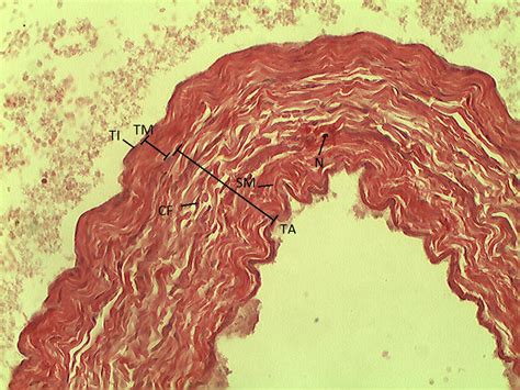 Large Vein 20X | Histology