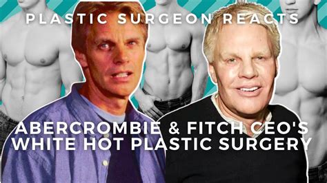 Mike Jeffries White Hot Plastic Surgery: Abercrombie's CEO Transformed - YouTube