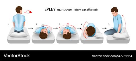 Epley maneuver right ear affected Royalty Free Vector Image