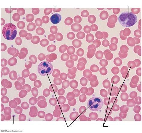 Blood Smear Model Labeled