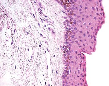 Histopathology of the Ocular Surface | IntechOpen