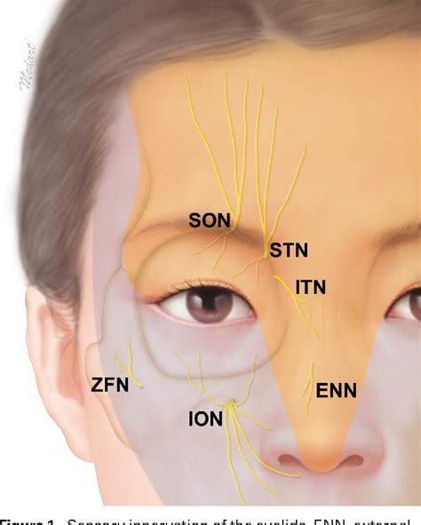 Emerging Points of the Supraorbital and Supratrochlear Nerves in the ...