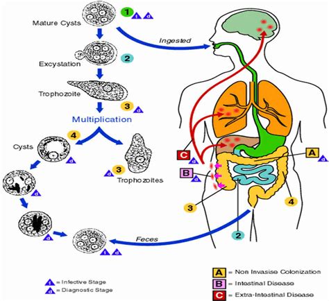 Amoebiasis Signs And Symptoms