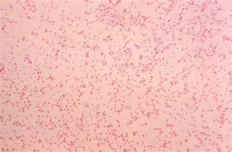 Neisseria Gram Stain