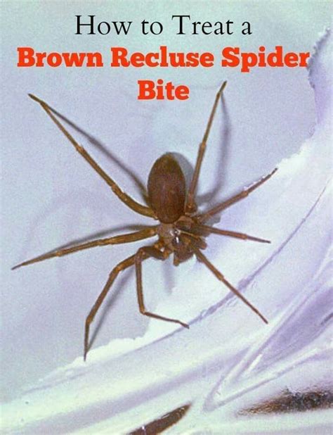 Brown recluse spider bite Spider Identification Chart, Spider Bite Treatment, Brown Recluse ...