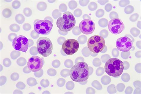 Polymorphonuclear Leukocytes White Blood Cells