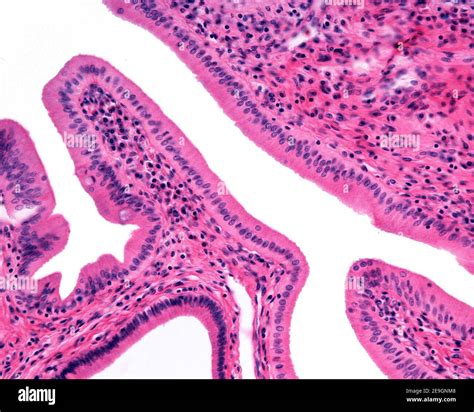 Common Bile Duct Histology