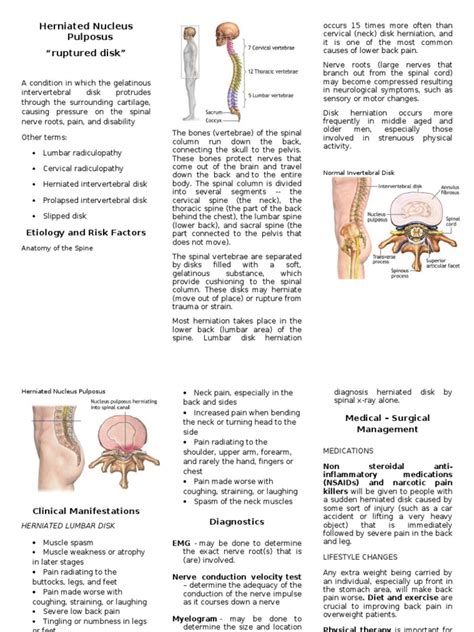 Herniated Nucleus Pulposus | Vertebral Column | Back Pain