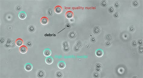 Nuclei Isolation for Single Cell: Which Method? - Single Cell Discoveries