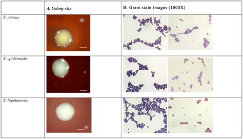 Staphylococcus Saprophyticus Gram Stain