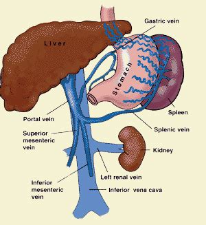 Portal Vein Thrombosis: Causes and Treatments Explained - EnkiVillage