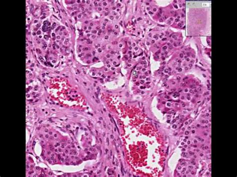 Leydig Cells Histology