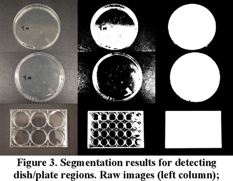 Figure 1 from An Automated Bacterial Colony Counting System | Semantic Scholar