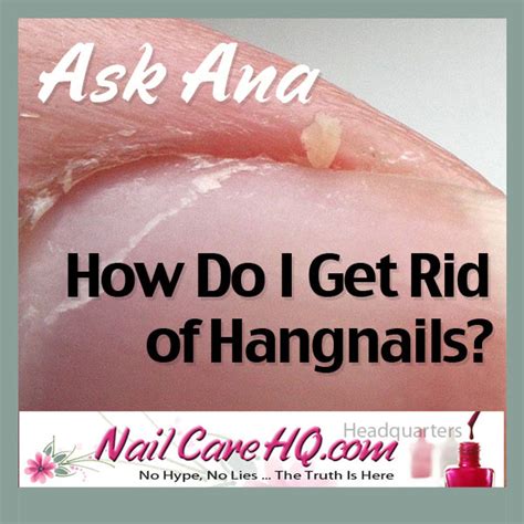 Hangnail-Treatment-600 - Nail Care HQ