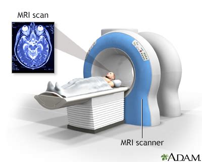 Mri Scan Brain Procedure