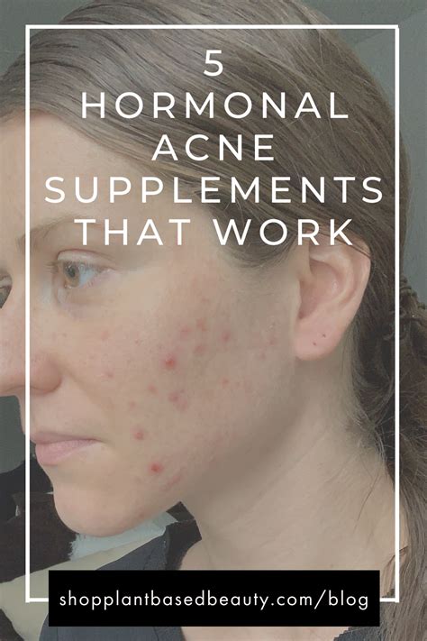 5 best hormonal cystic acne supplements - that actually work — Plant ...