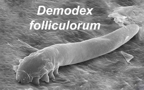 Demodex Folliculorum