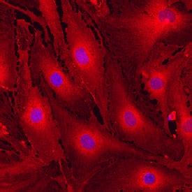 Mouse MCAM/CD146 Antibody MAB7718: R&D Systems