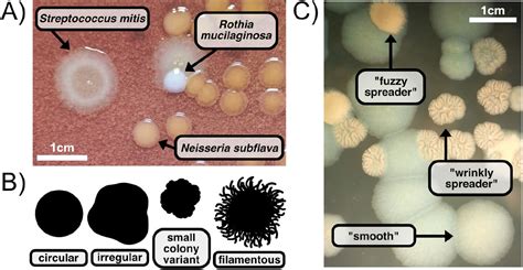 Pseudomonas Aeruginosa Colony Morphology