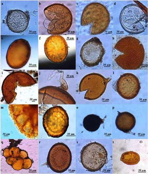 The Benefit of Fungal Spores - microBIOMETER